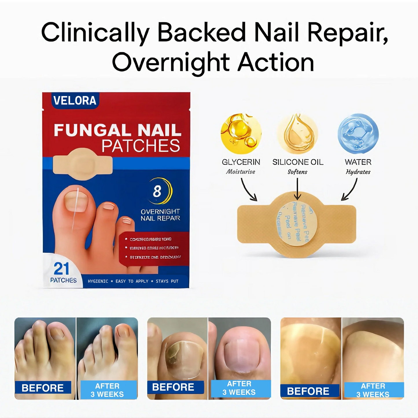 VELORA Fungal Nail Patches