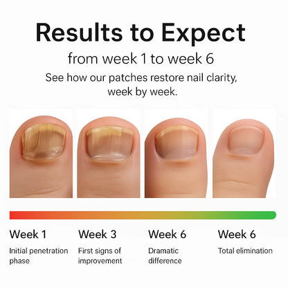 VELORA Fungal Nail Patches